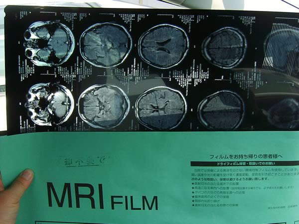 mri